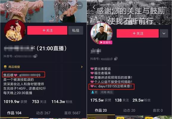抖音百万粉丝养成指南（如何让抖音粉丝涨到1000赞）