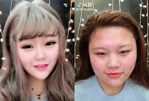 揭秘抖音医美违禁内容（千万别看！违禁医美内容曝光）