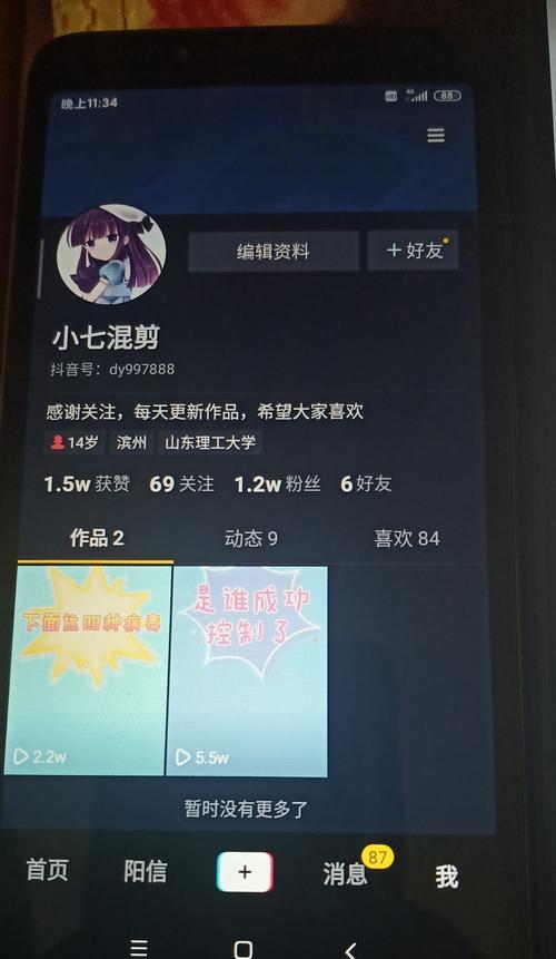 揭秘抖音粉丝牌一天升十级的方法（打造抖音人气新星）